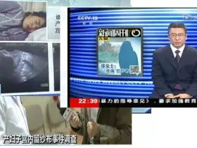 手术室护理实践指南-手术物品清点